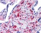 STAT5B antibody - middle region